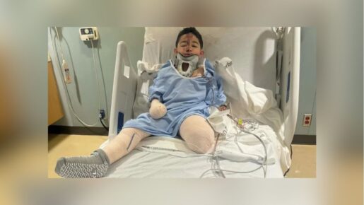 Dallas Boy Loses Leg After New Year’s Day Drunk Driving Crash