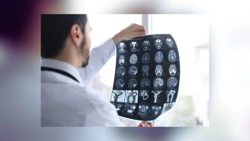 Study: Advanced CTE Linked To 4.5x Higher Dementia Risk