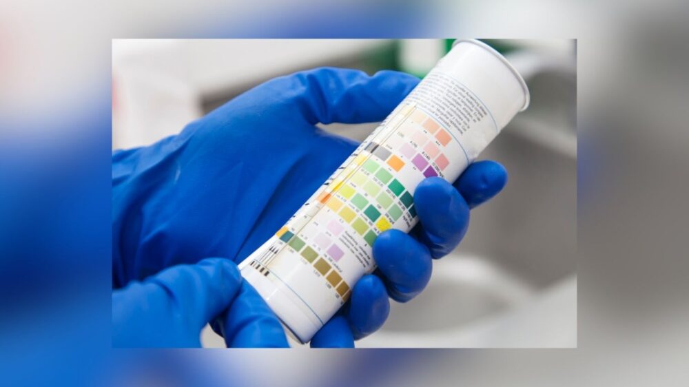 Global Spike In Diabetic Ketoacidosis Highlights Need For Early Ketone Monitoring