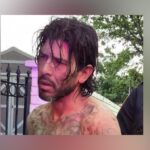 Fort Worth Police Civilian Employee Shot In Eye During Burglary Call – Suspect Arrested