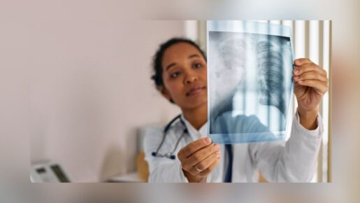 COVID-19 May Be Linked To Higher Lung Cancer Risk, Study Finds