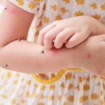 Dallas West Nile Alert: Spraying Scheduled For June 17-18 In Three Zones