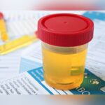 Labcorp To Pay $14.5M To Settle Medicare Fraud Allegations Over Unnecessary Drug Testing