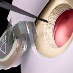 Neuralink Just Pierced The Brain’s Armor: First Human Transdural Implant Success