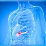 FDA Approves Pill That Nearly Doubled Median Survival In Pancreatic Cancer Trial