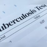 Irving ISD Recommends Tuberculosis Testing After Possible Exposure At MacArthur High