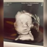 Viral ‘Hand of God’ Ultrasound From Kentucky Mom Still Inspires More Than A Year Later