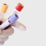 New Study Questions How Labs Define A ‘Normal’ Blood Count