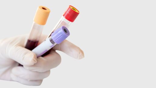 New Study Questions How Labs Define A ‘Normal’ Blood Count